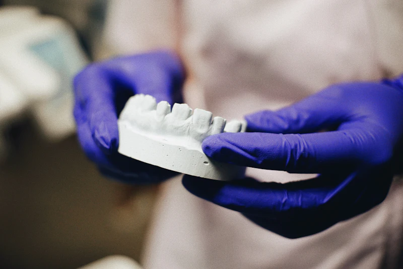 Gloved hands holding a plaster model of a row of teeth, the kind used to plan a new tooth
